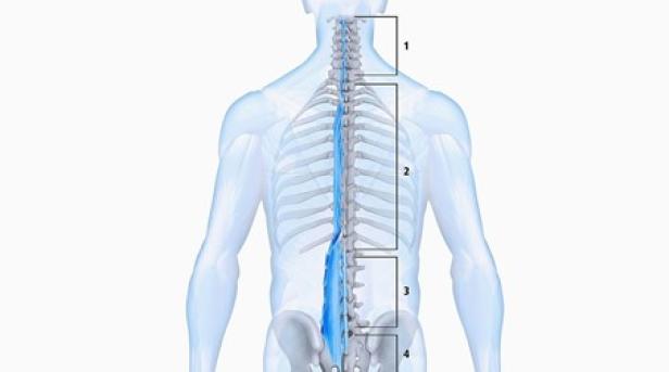 Das ist die häufigste Ursache für Rückenschmerzen