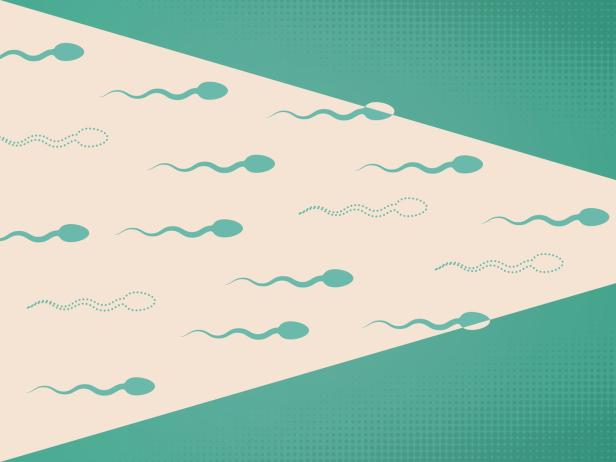 Substanz stoppt Spermien: Neuer Ansatz für Verhütung beim Mann?