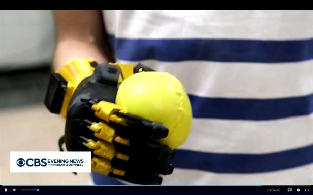 "Unvorstellbar": US-Schulklasse baute Handprothese für Mitschüler