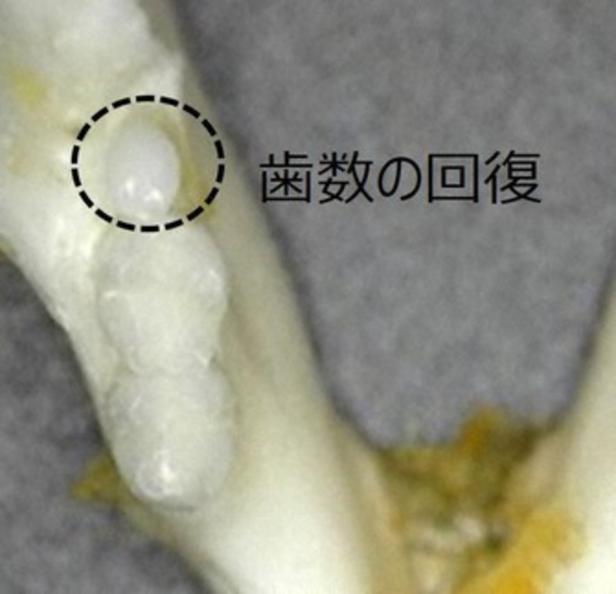 Japanische Forscher lassen dritte Zähne wachsen