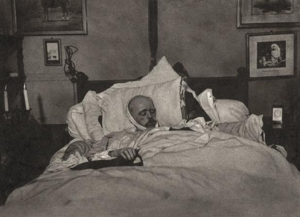 Ein Mann mit Verbänden liegt in einem Bett.