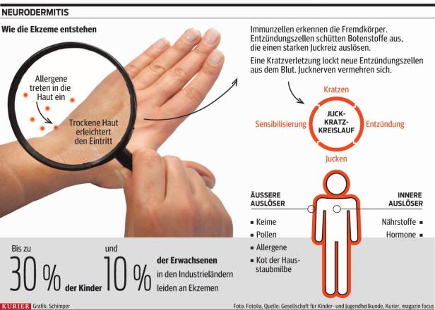 Blutwäsche gegen Juckreiz