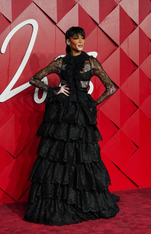 Winnie Harlow in einem langen, schwarzen Spitzenkleid auf einem roten Teppich.
