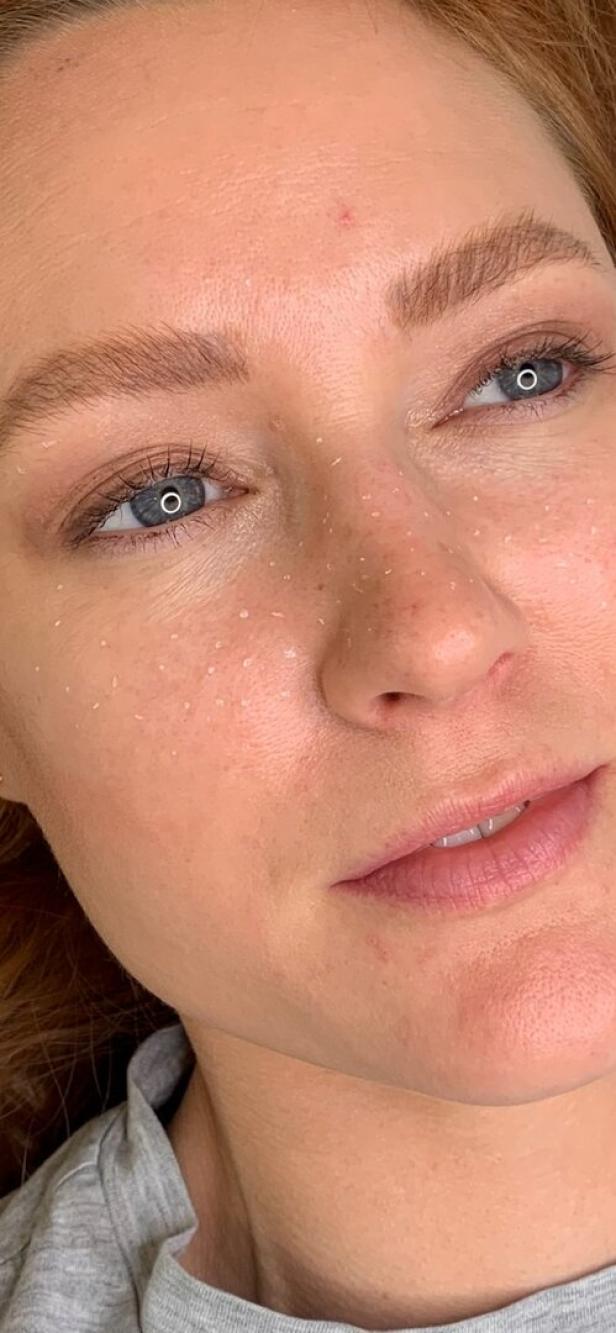 Das Gesicht einer Frau mit Sommersprossen und hellblauen Augen.