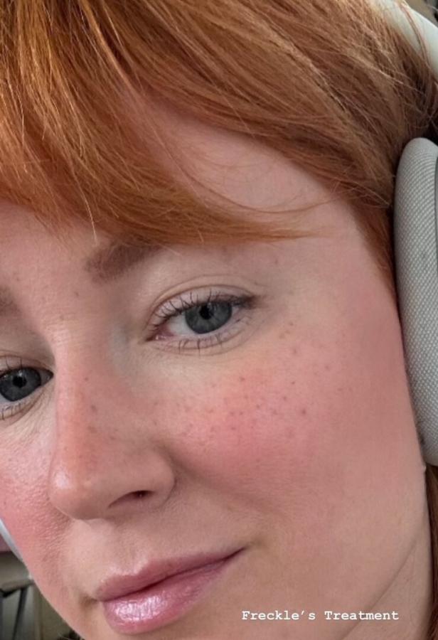 Nahaufnahme des Gesichts einer Frau mit Sommersprossen und roten Haaren.