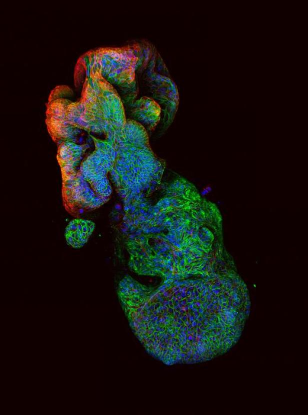 3D-Struktur eines aus menschlichen Darmkrebszellen gebildeten Organoids.