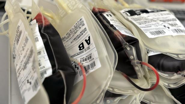 Mehrere Blutbeutel mit unterschiedlichen Blutgruppen liegen nebeneinander.