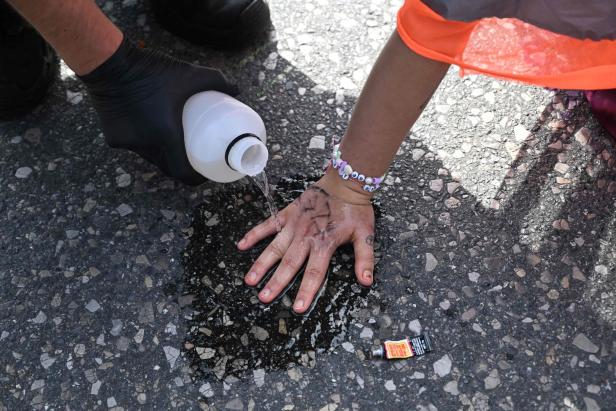 Eine Person löst Sekundenkleber mit Wasser von ihrer Hand.