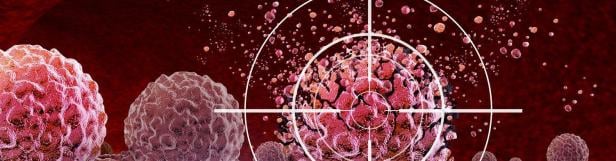 Ultrasound Cancer Treatment