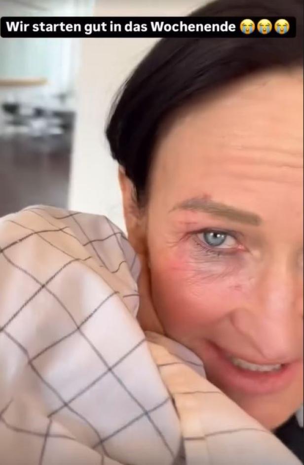 Autsch! Für Eva Glawischnig gab's beim "Dancing Stars"-Training was aufs Auge