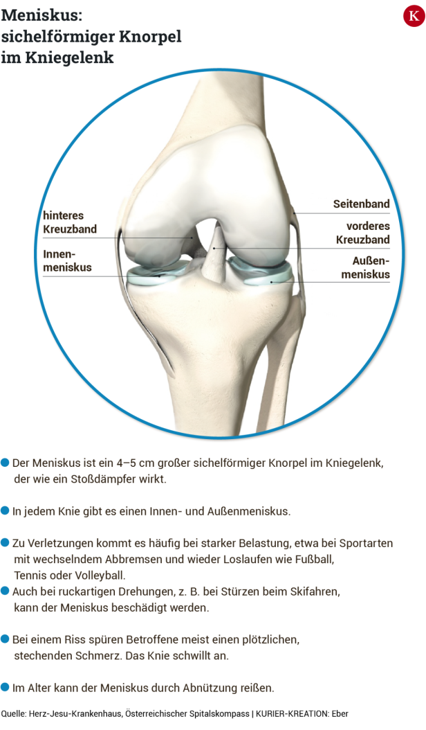 Eine Illustration eines Kniegelenks mit Beschriftungen der Menisken und Kreuzbänder.