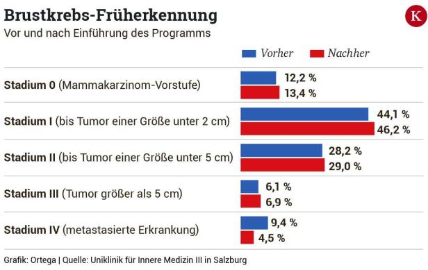 Mankos bei Mammografie-Vorsorgeprogramm in Österreich