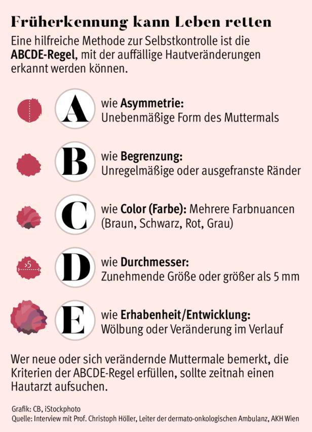 Hautkrebs-Gefahr: Wer besonders betroffen ist und wie man ihn frühzeitig erkennt