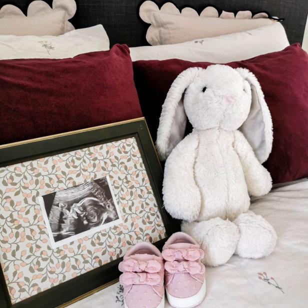 Babyschuhe und Stoffhase neben Ultraschallaufnahme.