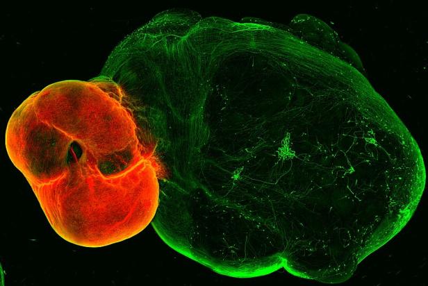 An diesem speziellen Gehirn-Organoid können Therapien gegen Parkinson getestet werden.