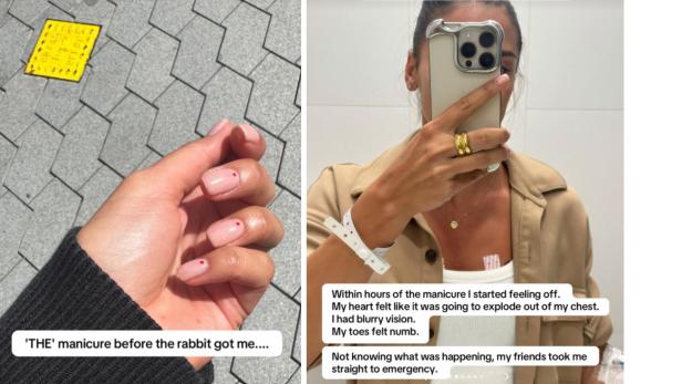 Linke Bildhälfte zeigt eine Hand mit frischer Maniküre, rechte Hälfte eine Frau mit Krankenhausarmband.