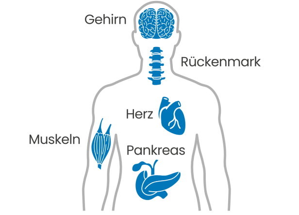 Grafische Darstellung der Körperregionen Gehirn, Rückenmark, Muskeln, Herz und Pankreas, die bei Friedreich Ataxie betroffen sein können.