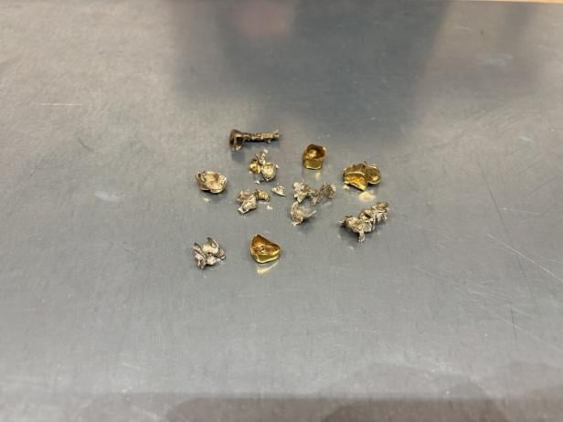 Mehrere Stücke Zahngold die auf einem Tisch liegen.