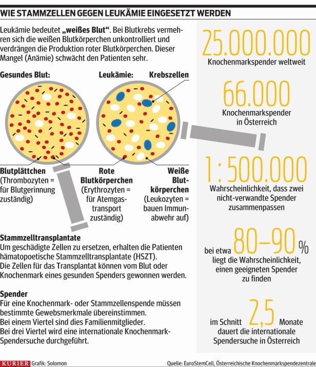 Leukämie: So funktioniert die Stammzellspende