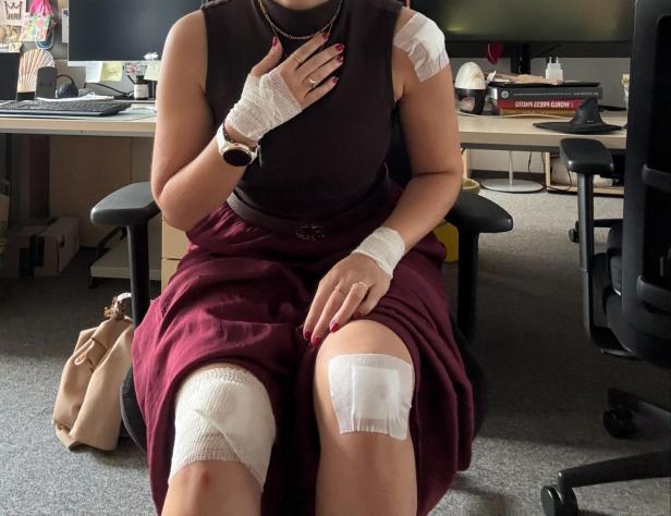 Aufgeschlagene Knie und Handgelenke