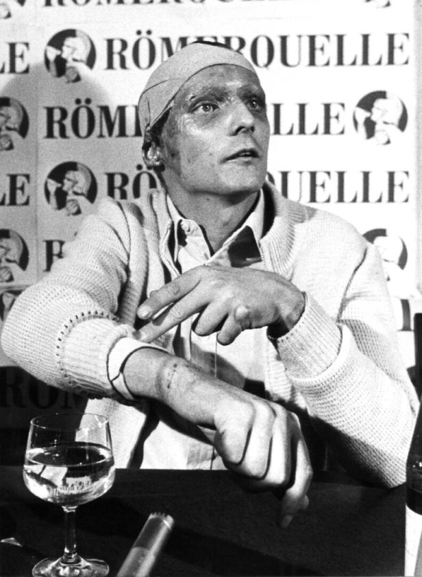 Formula 1 pilot Niki Lauda survives accident at Nuerburgring 1976
