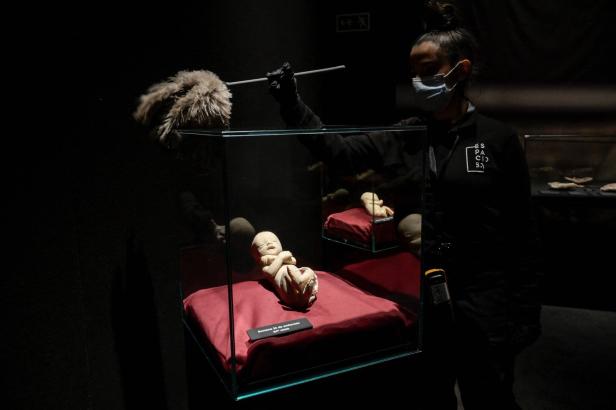 SPAIN-ART-SCIENCE-ANATOMY-EXHIBITION