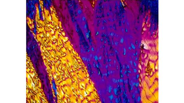 Mikroskop: So sieht Cola-Rum wirklich aus