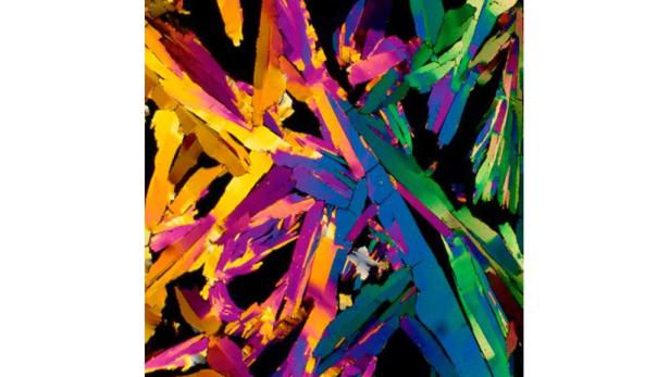 Mikroskop: So sieht Cola-Rum wirklich aus