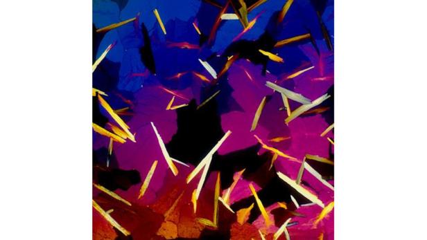 Mikroskop: So sieht Cola-Rum wirklich aus