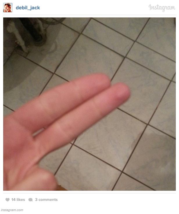 Eine Hand zeigt zwei Finger vor einem gefliesten Hintergrund.
