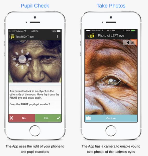 Zwei Smartphone-Screenshots einer App zur Pupillenprüfung und zum Fotografieren von Augen.