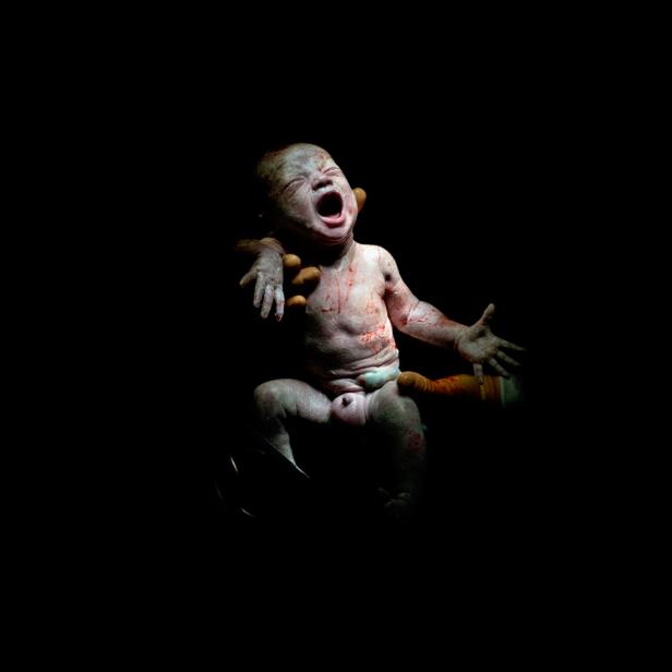 Fotoserie zeigt Babys Sekunden nach dem Kaiserschnitt