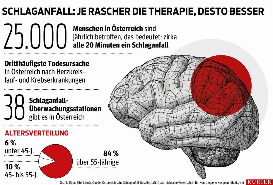 Kann Man An Einem Schlaganfall Sterben kurier.at