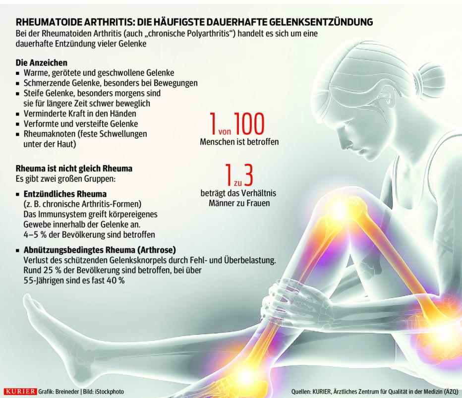 Entzündliches Rheuma: Wie sich die Therapien verbessert haben | Kurier