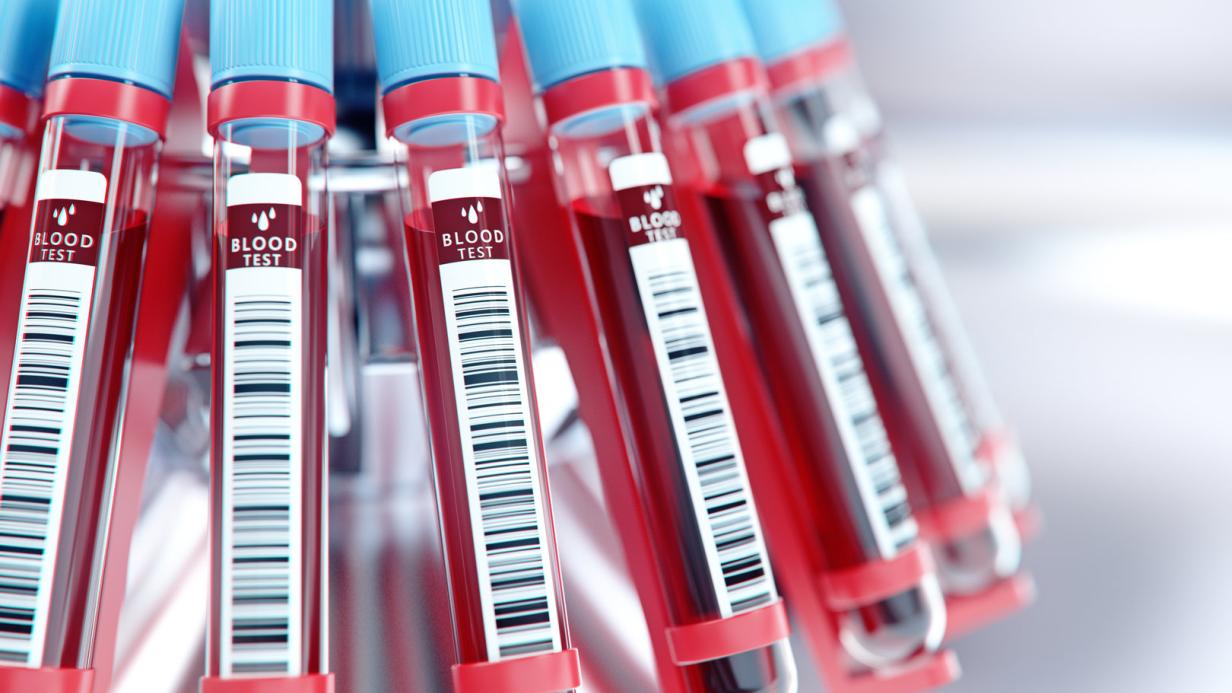 Doping Netzwerk aufgeflogen: Ein neuer Fall vor dem großen Doping Netzwerk aufgeflogen: Ein neuer Fall vor dem großen