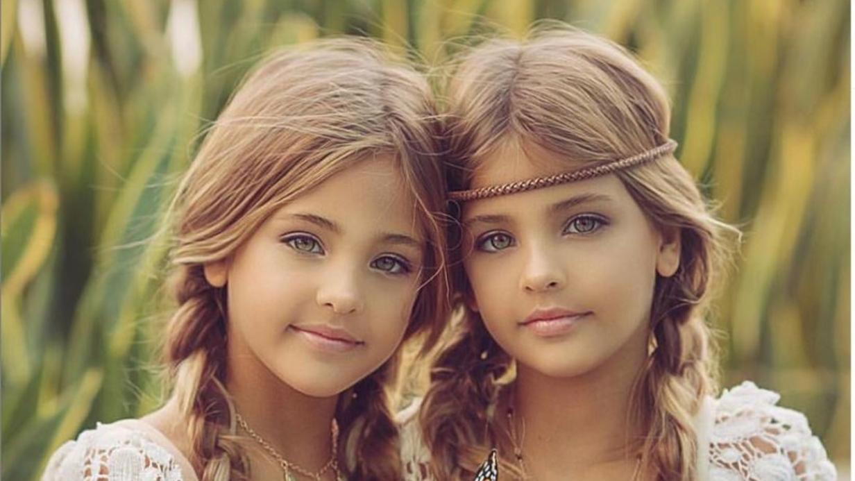 Instagram-Hype um die schönsten Zwillinge der Welt | kurier.at