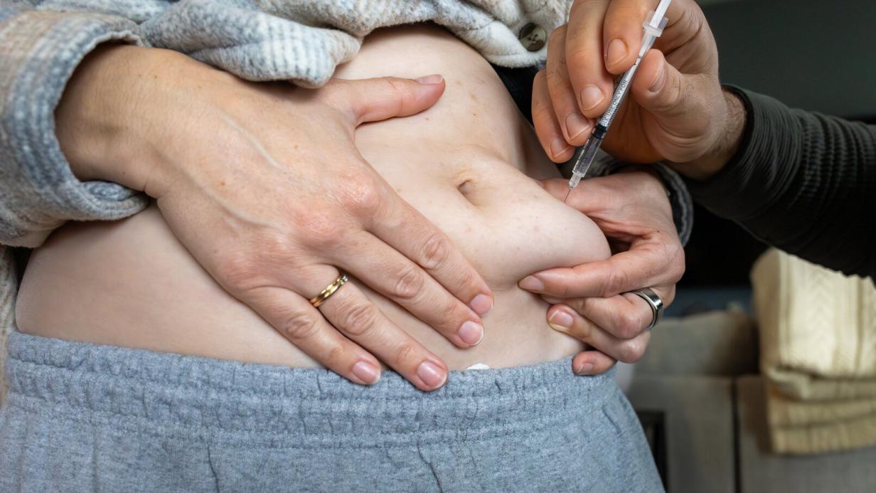 glp-1-rezeptoragonist libido sexualfunktion Clinical review of how glucagon-like peptide-1 agonist obesity medications decrease sexual desire, and a biopsychosocial model for why we don't 'see' it When GLP-1s Change Patients' Libido:
