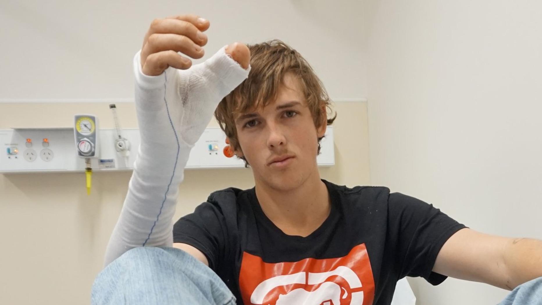 How Jarppi Lost His Thumb