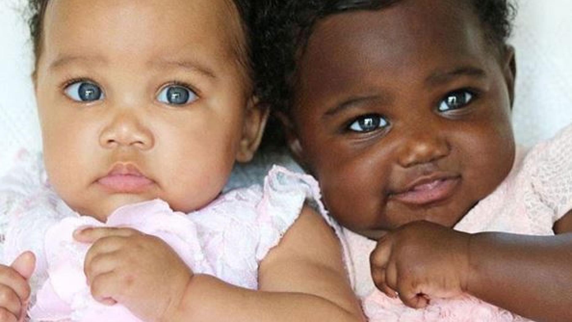 Две черные близняшки. Близняшки Биггс. Разноцветные Близнецы. Близняшки с разным цветом кожи. Двойняшки с разным цветом кожи.