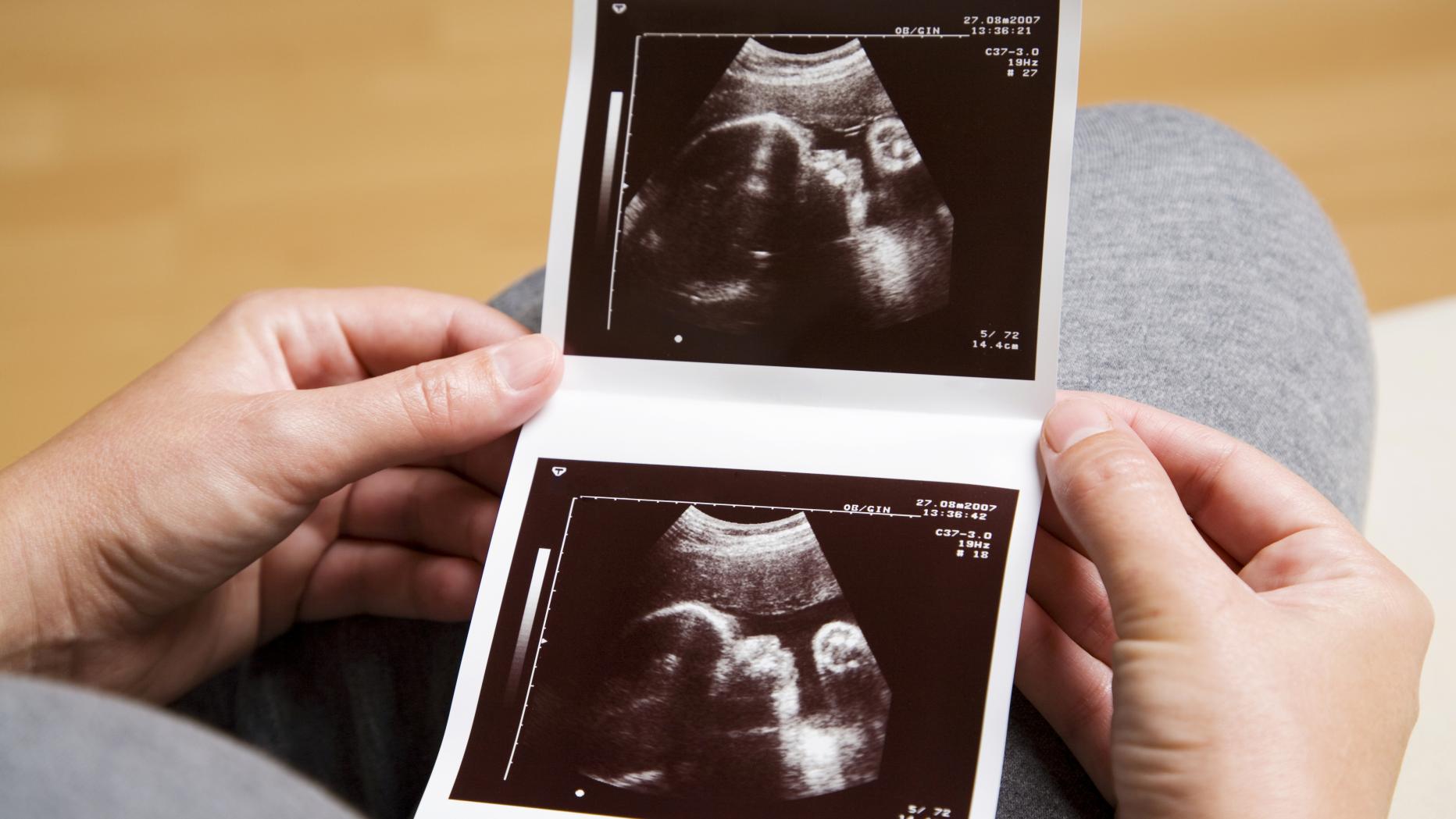Anzeichen ultraschall junge oder Ultraschall geschlecht