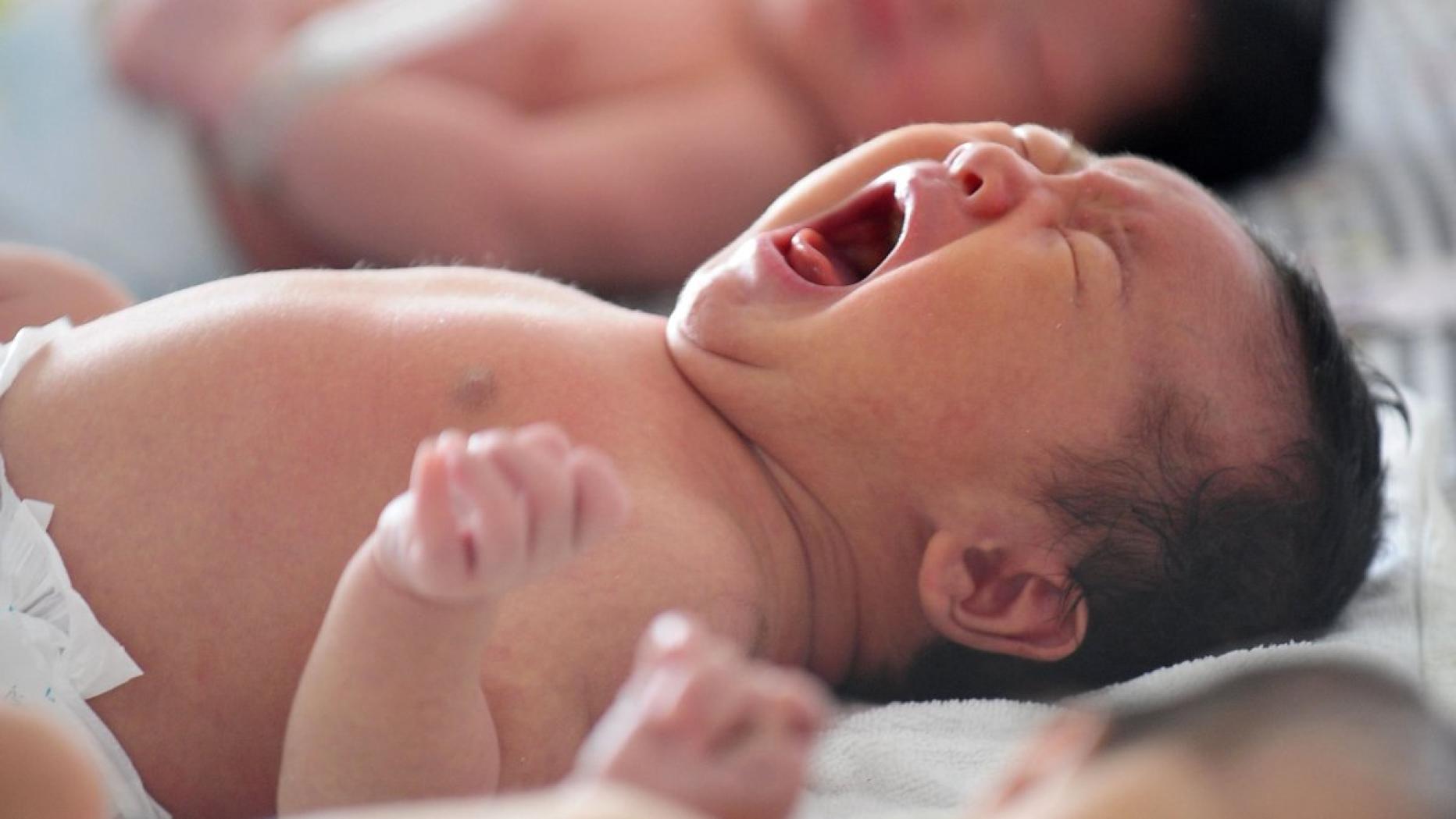 асфиксия новорожденных фото
