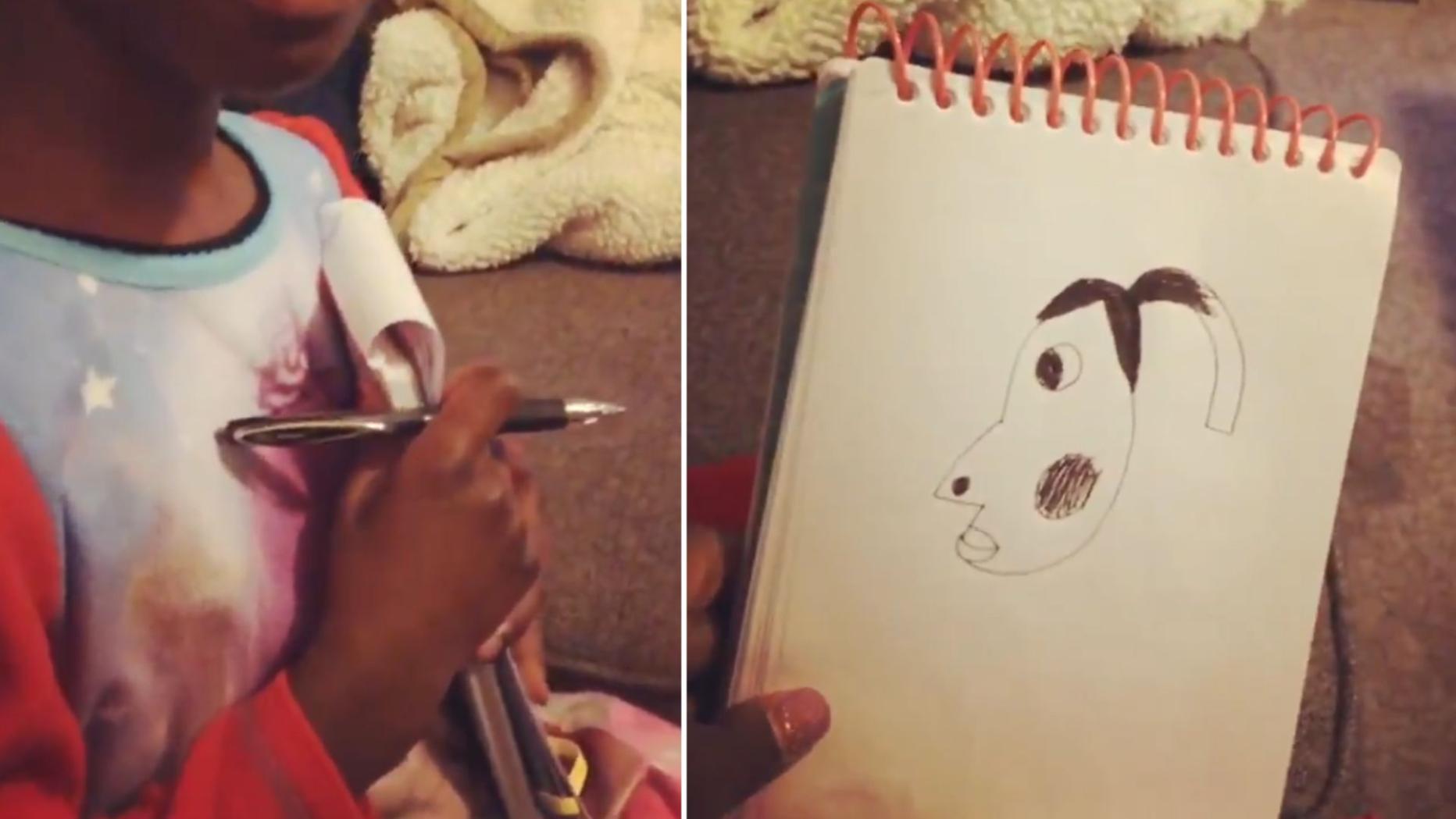 Hyperpigmentation-Meme auf Tiktok: Familie stellt Original-Video nach
