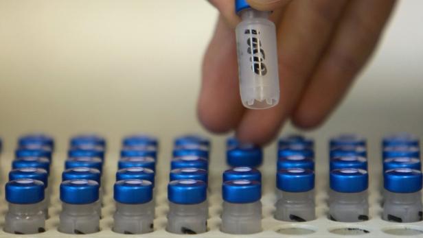 Eine Hand hält ein Probenröhrchen über eine Reihe von weiteren Röhrchen mit blauen Deckeln.