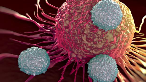 Attackierte Krebszelle: Immuntherapien lösen die Bremsen der Abwehr.