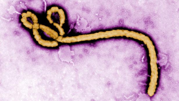 UGANDA EBOLA VIRUS