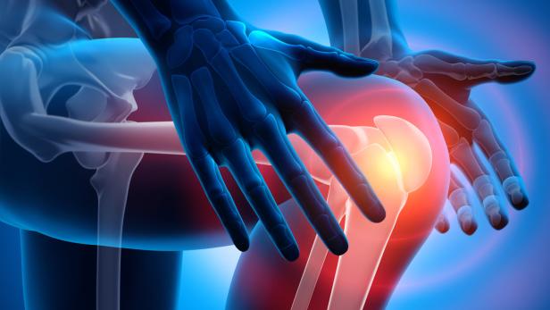 Knieschmerzen können viele Ursachen haben und müssen unbedingt abgeklärt werden
