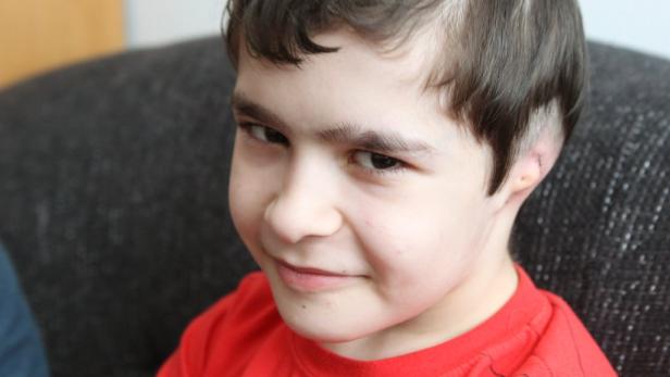 Kind erhielt völlig neues Hörimplantat