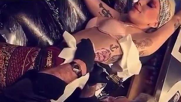 Lady Gaga hat sich David Bowie stechen lassen