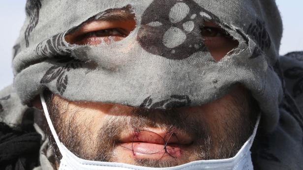 An Iranian migrant, his lips sewn shut, is seen ne