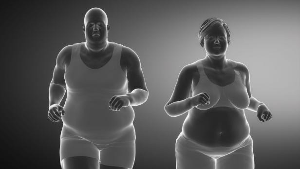 Übergewichtige mit Vorurteilen wie &quot;faul&quot; zu konfrontieren, löst massiven Schaden aus.